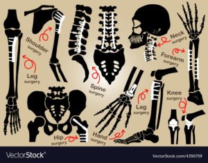 ortho admission after MBBS 